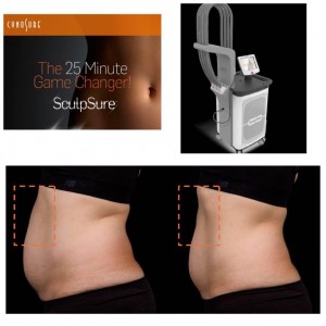 SculpSure -Dr Laura Anca Dermatology - www.ghidulmedical.com