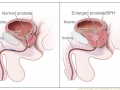 Centrul de Urologie Laser Timisoara ( laser timisoara - prostata timisoara ) 